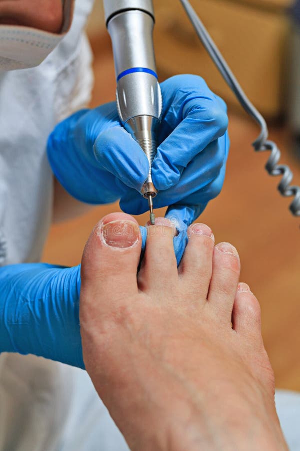chiropody imagens de stock chiropody imagens de stock