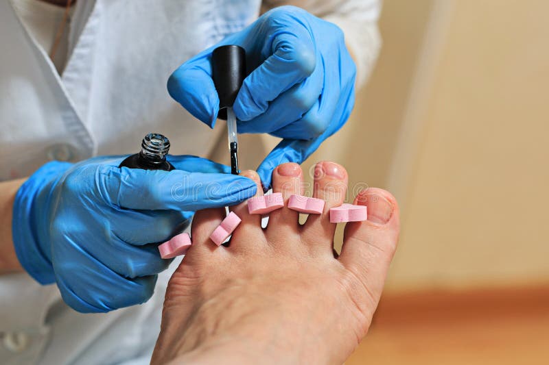 chiropody foto de stock chiropody foto de stock