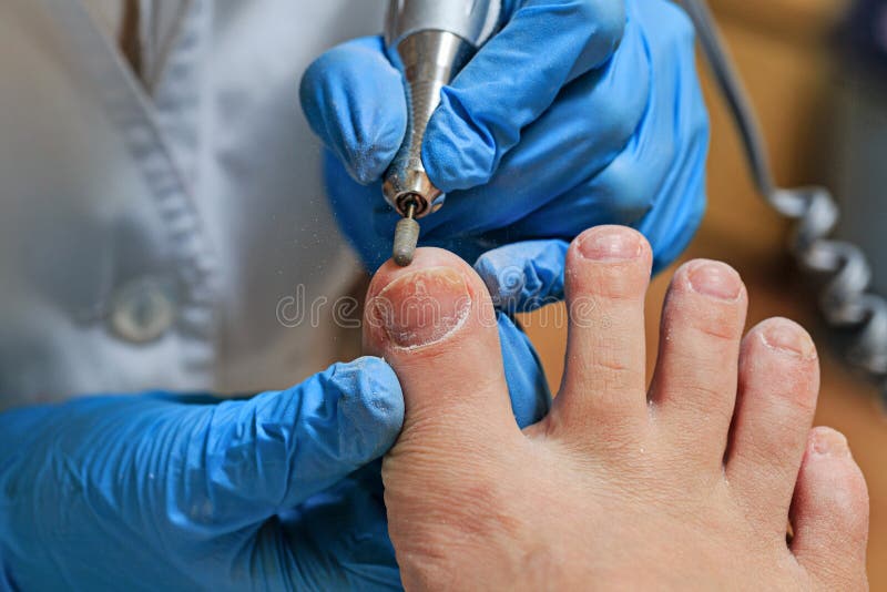 chiropody imagem de stock chiropody imagem de stock