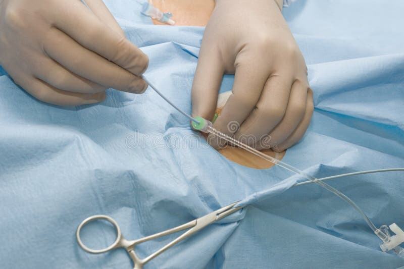 Chirurg die een flexibele catheter manipuleert stock afbeeldingen Chirurg die een flexibele catheter manipuleert stock afbeeldingen