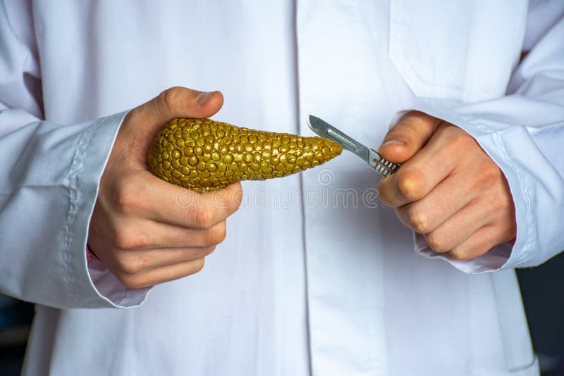 Chirurg hielt Skalpell über anatomischem Modell der menschlichen Pankreasdrüse, die es in ihrer Hand gegen Hintergrund des Körpers stockfotos