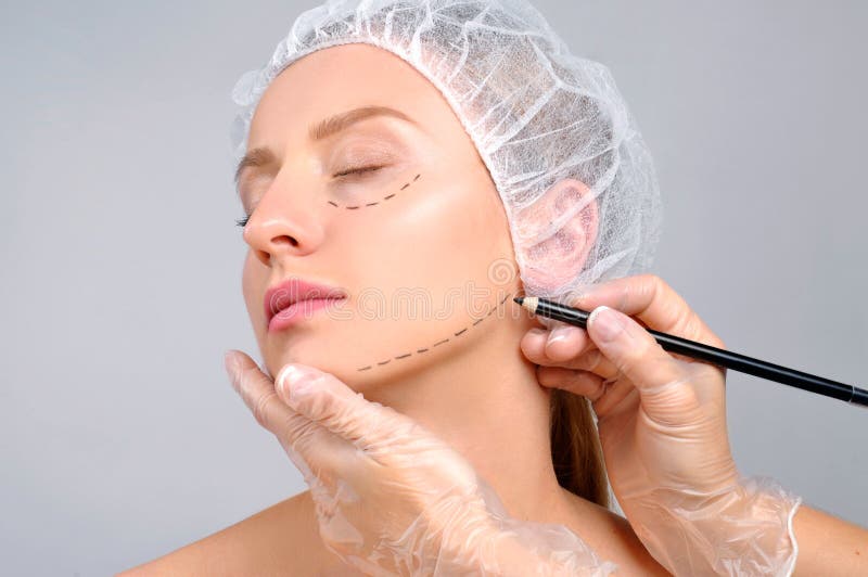 Chirurgia plastica Aggiusti le linee di perforazione del disegno sul fronte del ` s della donna fotografie stock libere da diritti Chirurgia plastica Aggiusti le linee di perforazione del disegno sul fronte del ` s della donna fotografie stock libere da diritti