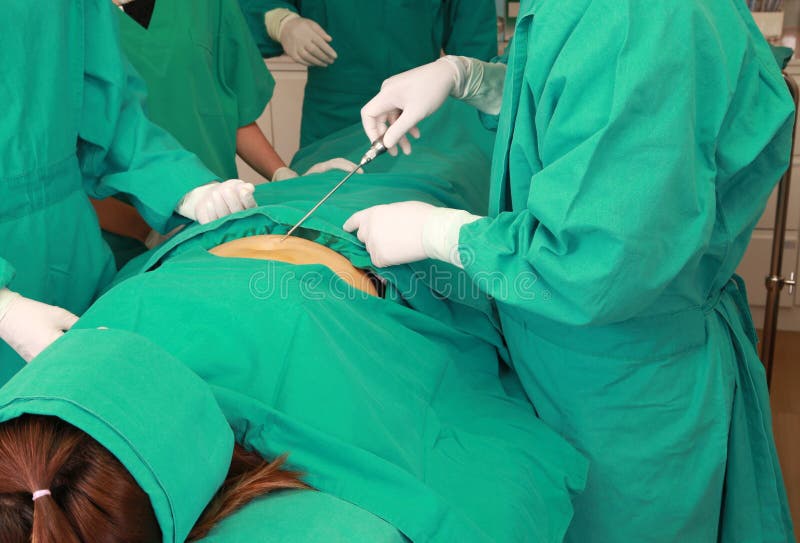 Chirurgie cosmétique de liposuccion dans la salle d'opération réelle photographie stock Chirurgie cosmétique de liposuccion dans la salle d'opération réelle photographie stock