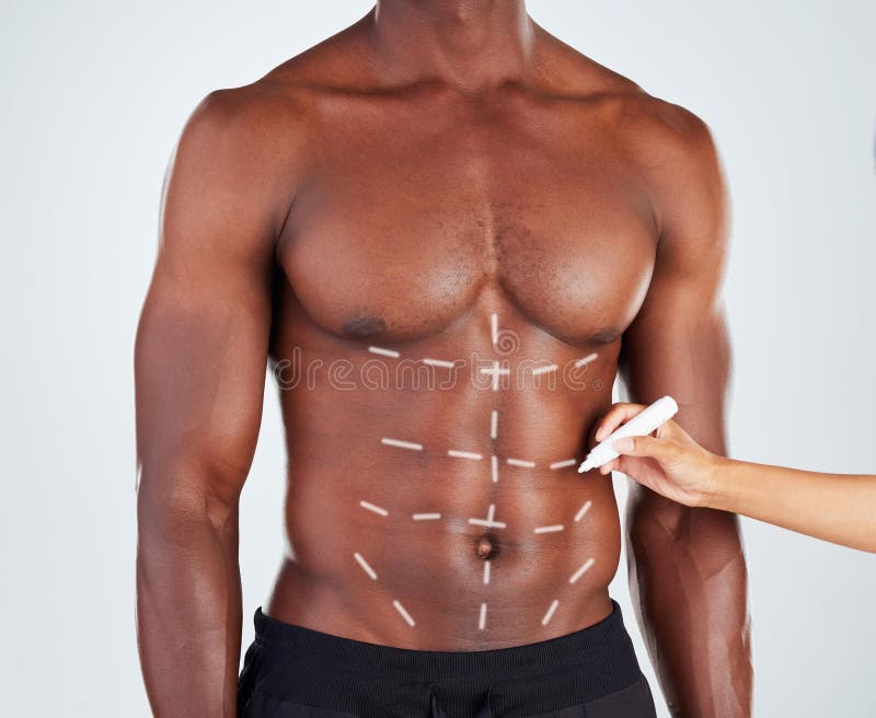 Chirurgo plastico e linee sull'addome con procedura per la modifica dello stomaco e il riempimento cosmetico. disegno a mano e fotografie stock libere da diritti