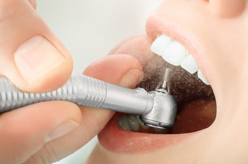 Chiuda su della perforazione manuale del dentista i denti e la spruzzatura dell'acqua immagini stock libere da diritti Chiuda su della perforazione manuale del dentista i denti e la spruzzatura dell'acqua immagini stock libere da diritti