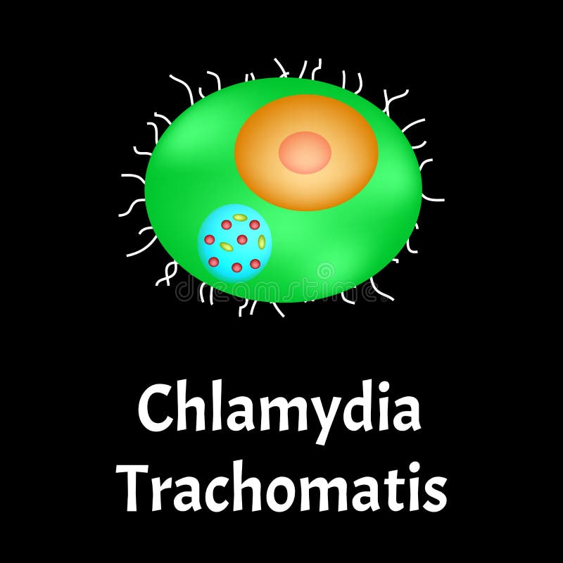 Chlamydia Trachomatis. Bacterial Infections Chlamydiosis. Sexually  Transmitted Diseases. Infographics. Vector Stock Vector - Illustration Of  Herpes, Health: 180068960