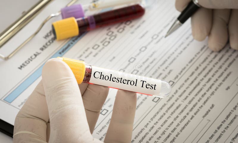 Cholesterol test stock image Cholesterol test stock image