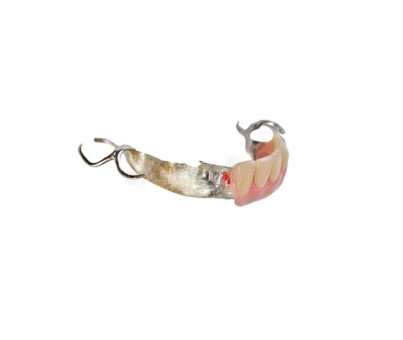 457 Clasp Denture Stock Photos - Free & Royalty-Free Stock Photos from ...