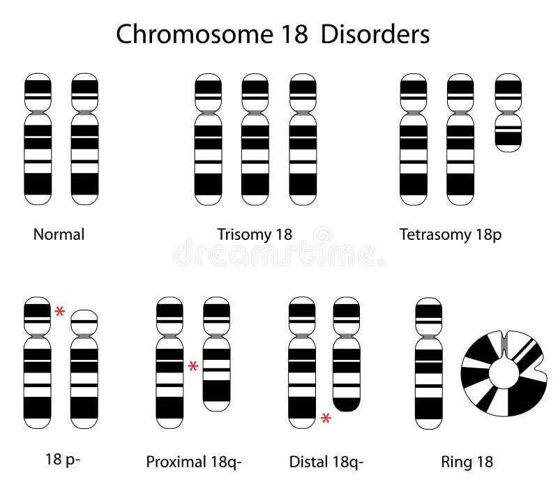 3p mosaic deletion duplication syndrome 3p mosaic deletion duplication syndrome