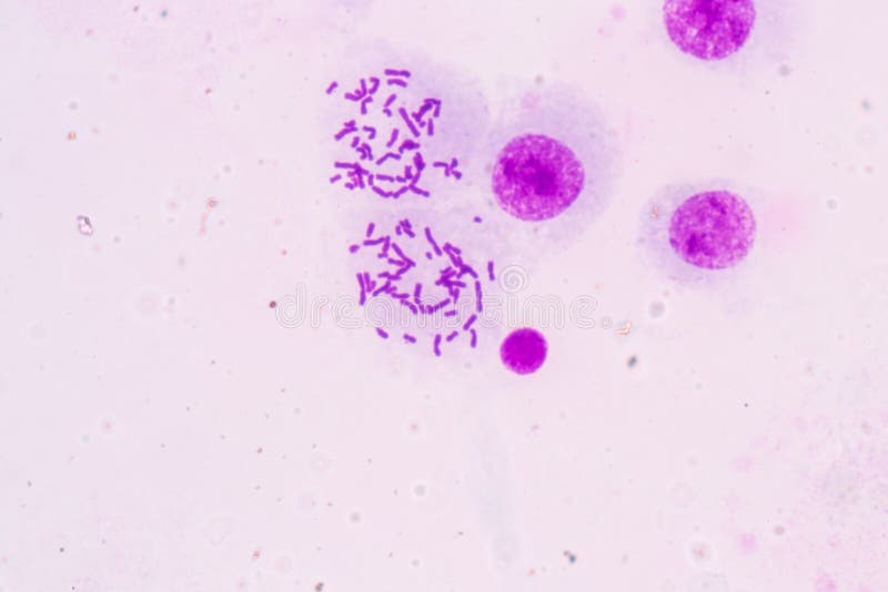 Chromosomes Human under the microscope for education. Gene sequence stock images, royalty-free photos and pictures