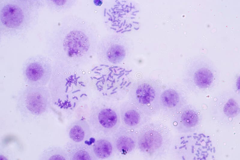 Chromosomes Human under the microscope for education in Lab. Gene sequence stock images, royalty-free photos and pictures