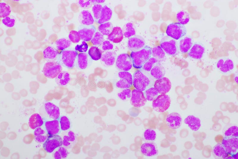 Chronic myeloid leukemia cells or CML