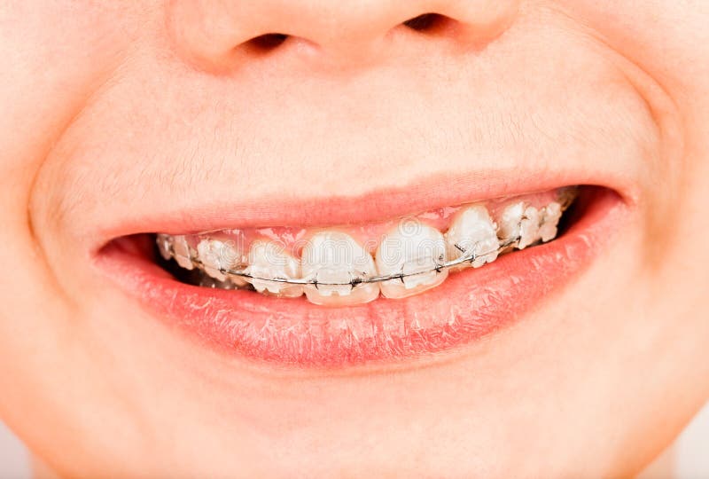 Cintas imagens de stock royalty free