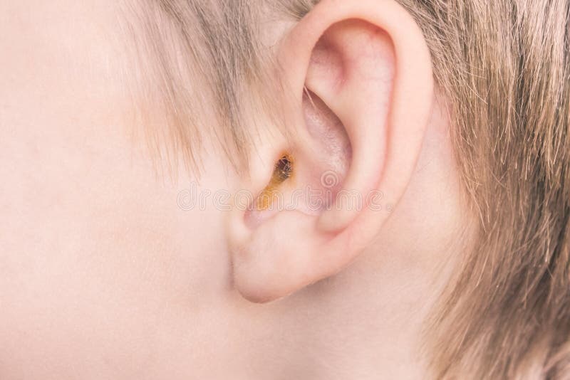 Cire D'oreille Sale De L'enfant Près. Hygiène Des Oreilles Photo