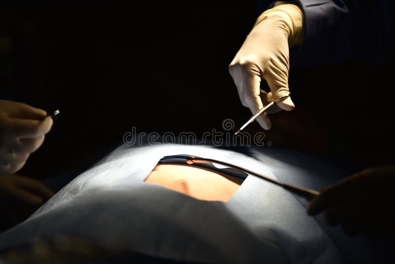 Cirujano de las personas en el trabajo en sala de operaciones Luz quirúrgica en la sala de operaciones imágenes de archivo libres de regalías Cirujano de las personas en el trabajo en sala de operaciones Luz quirúrgica en la sala de operaciones imágenes de archivo libres de regalías