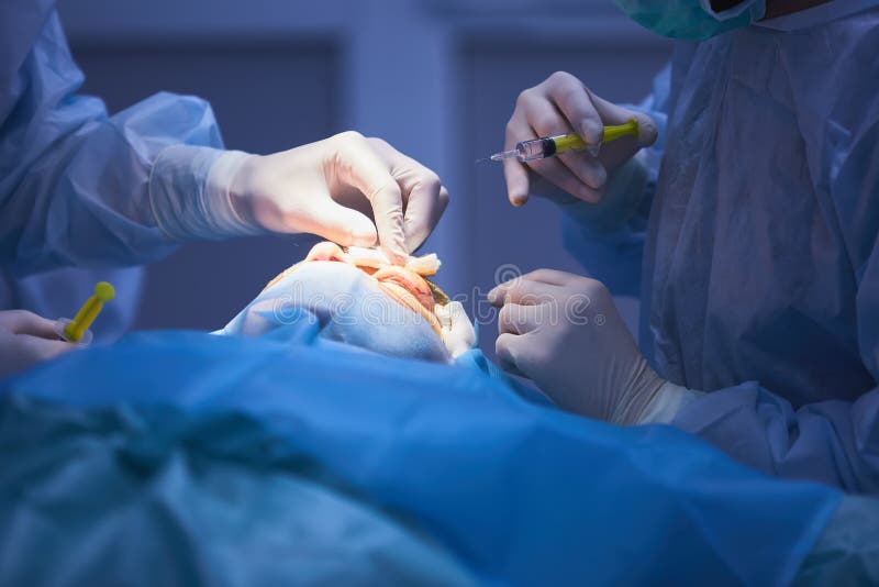 Cirurgia plástica da pálpebra na sala de operações, blepharoplasty fotos de stock Cirurgia plástica da pálpebra na sala de operações, blepharoplasty fotos de stock