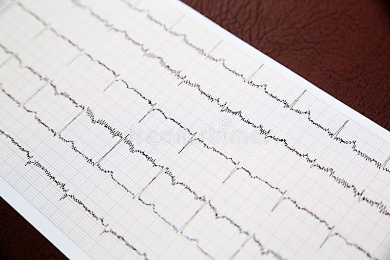 Ciérrese para arriba del papel del electrocardiograma de ECG imagen de archivo Ciérrese para arriba del papel del electrocardiograma de ECG imagen de archivo