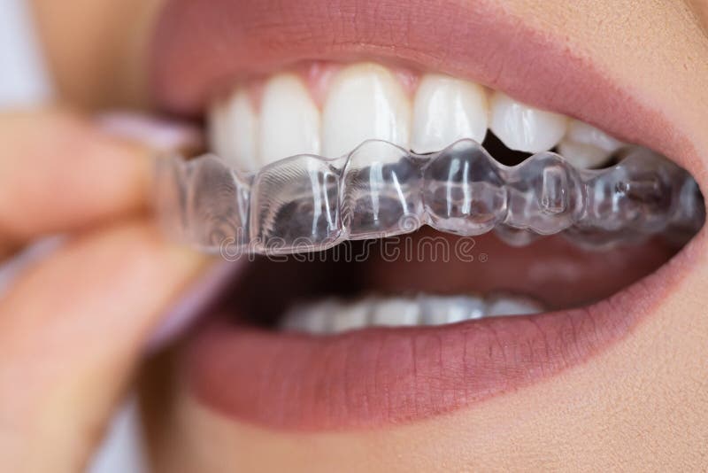 Clear Aligner Dental Night Guard Stock Image Image of teeth