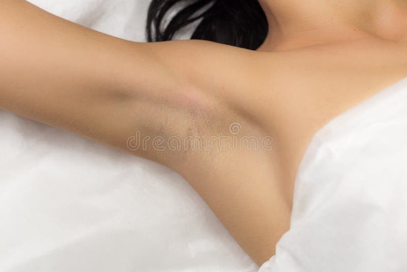 Underarm girl client after the procedure, laser hair removal in professional beauty studio. Client in white towel lies on the couch. Underarm girl client after the procedure, laser hair removal in professional beauty studio. Client in white towel lies on the couch.