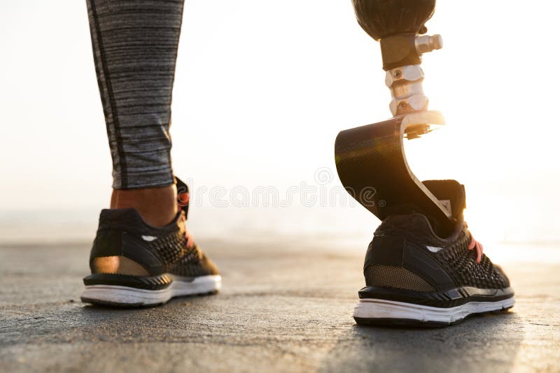1,402 Woman Prosthetic Leg Stock Photos - Free & Royalty-Free Stock Photos  from Dreamstime