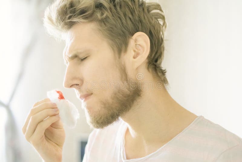 Close up bearded man portrait suffer from nose bleed using wadding tampon f stock photo Close up bearded man portrait suffer from nose bleed using wadding tampon f stock photo