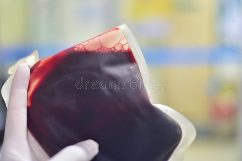 Close Up Blood Bag in Laboratory Stock Image Image of care, research