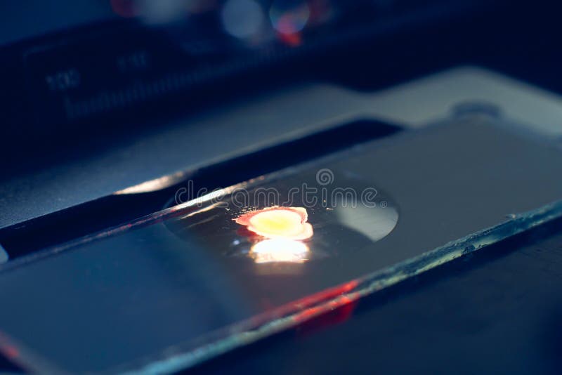 Close Up of Blood Sample on a Microscope Glass Stock Image Image of