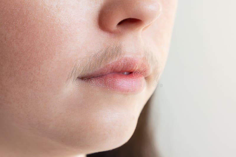 444 Upper Lip Hair Stock Photos - Free & Royalty-Free Stock Photos from  Dreamstime