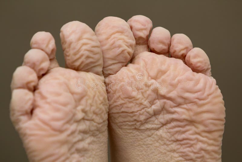 Feet pics wrinkled www.flowercitypest.com