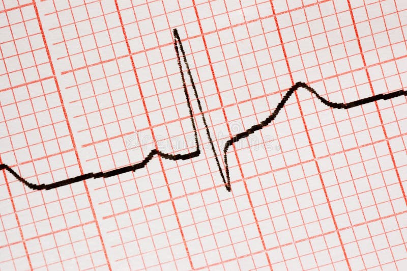 Close Up Of Ecg Graph Picture. Image 3272963
