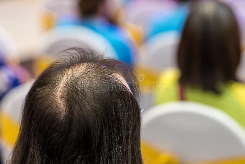 1,441 Top Head Hair Close Up Stock Photos - Free & Royalty-Free Stock  Photos from Dreamstime