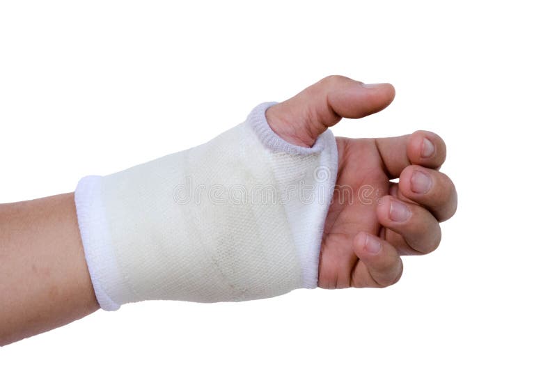 Close-up hand splint for broken bone treatment isolated royalty free stock photo