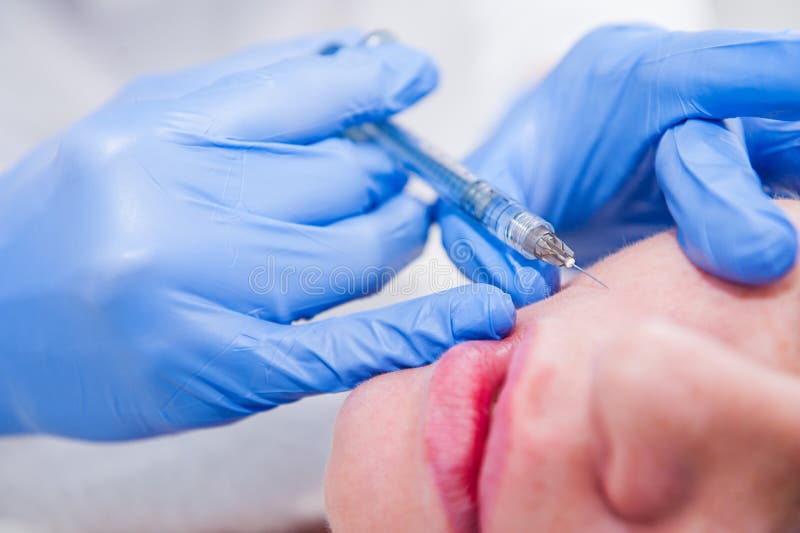 Close up Hands of cosmetologist making injection in face, lips. Young woman gets beauty facial injections in salon. Face aging, re