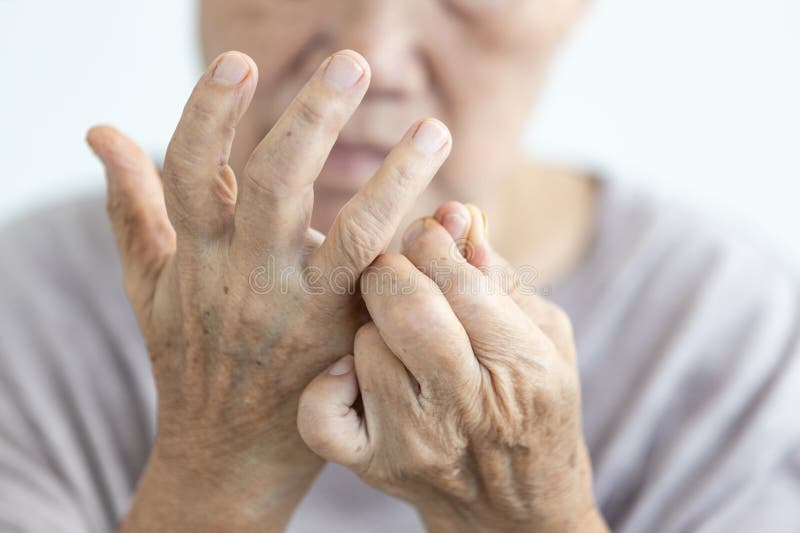 Close up of hands,senior woman suffering Rheumatoid Arthritis,Osteoarthritis,Gout,Rheumatism,old elderly has pain in her fingers stock images
