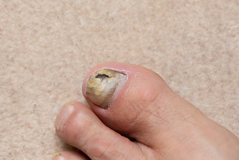 tiny balls that itch on feet tiny balls that itch on feet