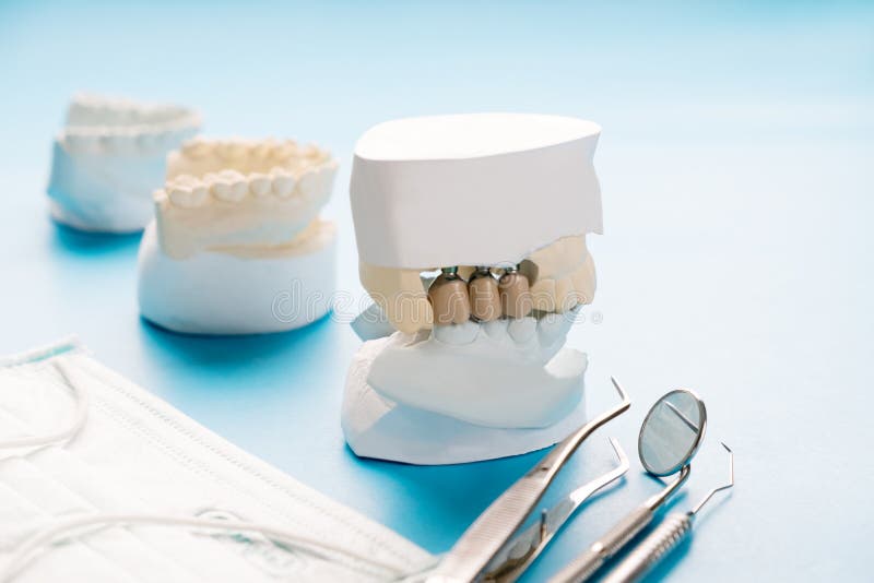 Протезирование зубов инвалиду 1 группы. Лента белая стоматология для протезирования. Prosthodontic Crown. Льготное зубопротезирование картинки.