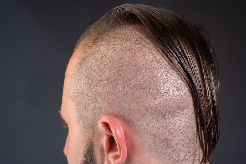 Close Up Male Haircut. Hairstylist Bold Head. Barbershop Concept. Man Barber Hairstylist. Stock Image - Image of bold, hairsalon: 223446833 Close Up Male Haircut. Hairstylist Bold Head. Barbershop Concept. Man Barber Hairstylist. Stock Image - Image of bold, hairsalon: 223446833