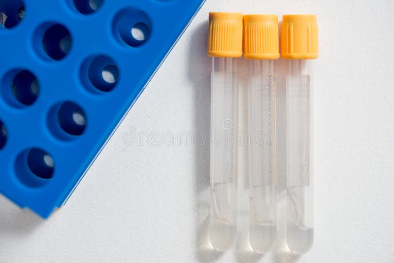 Close-up of plastic test tubes with a yellow lid in a tripod. In the scientific laboratory. Preparation for the medical experiment royalty free stock photos Close-up of plastic test tubes with a yellow lid in a tripod. In the scientific laboratory. Preparation for the medical experiment royalty free stock photos