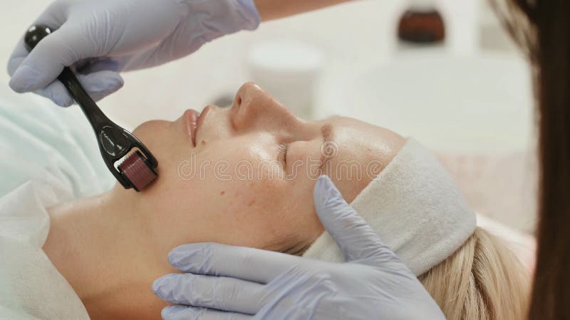 Close-up portrait of woman having beauty skin treatment. Therapist preparing skin with derma roller.