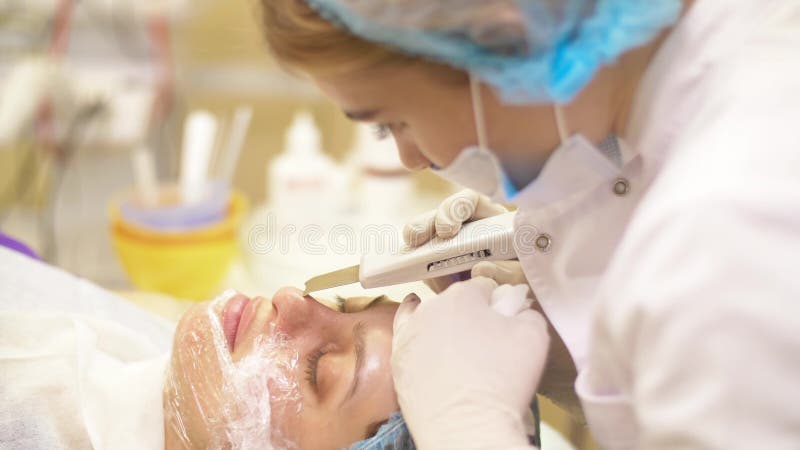 Close up procedure laser removal of black dots from the skin of a young woman in a cosmetic clinic.