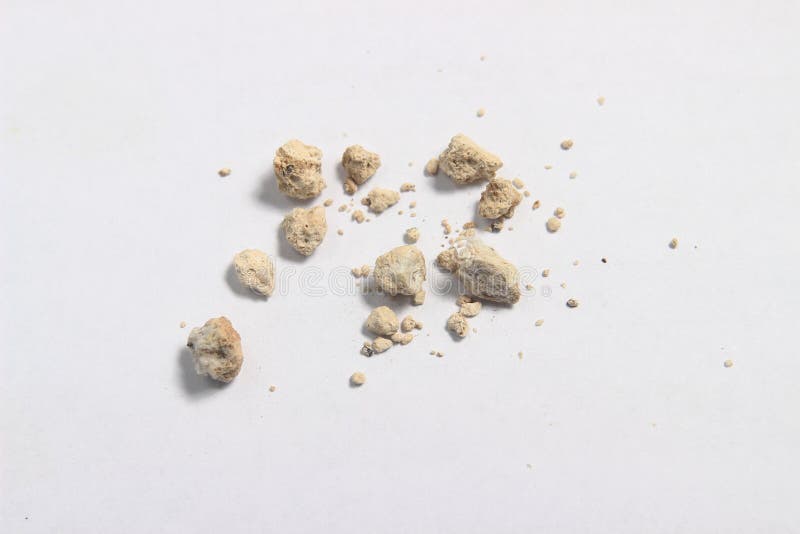 Close up very small kidney stones at white background. Close up very small kidney stones at white background