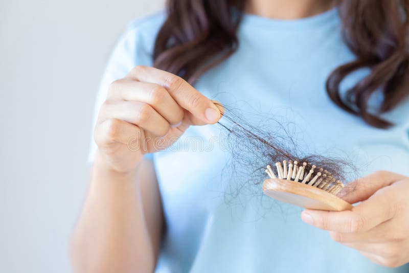 Close Up of Woman Hair Loss Problem on Hand Lack Stock Image - Image of  lose, lines: 180208087