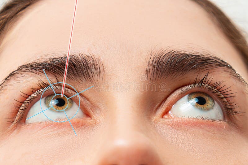 Close up of woman&#x27;s eyes looking up and laser beam lighting at pupil of the eye. The concept of Laser eye surgery and ophthalmology.