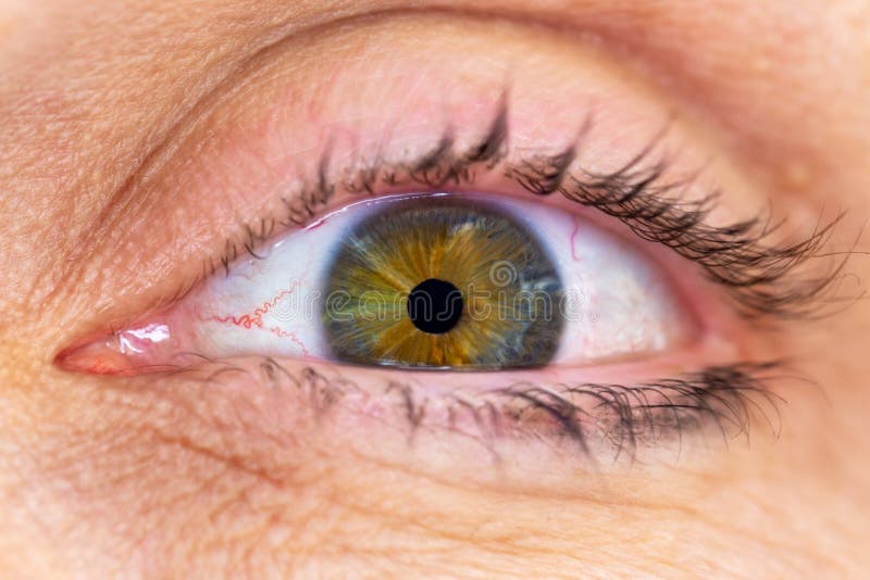 Closeupmacro Van Een Menselijk Oog Met Groene En Bruine Iris Met Het Omringen Van Rijpe Huid