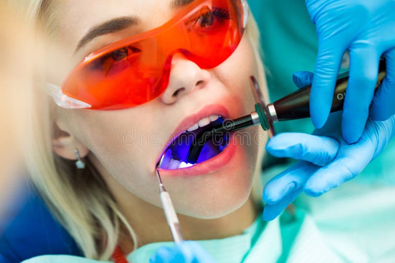 Close-upportret van een vrouwelijke patiënt bij tandarts in de kliniek Tanden die procedure met ultraviolet licht UVlamp witten stock foto's Close-upportret van een vrouwelijke patiënt bij tandarts in de kliniek Tanden die procedure met ultraviolet licht UVlamp witten stock foto's