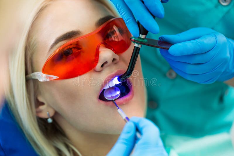 Close-upportret van een vrouwelijke patiënt bij tandarts in de kliniek Tanden die procedure met ultraviolet licht UVlamp witten royalty-vrije stock foto Close-upportret van een vrouwelijke patiënt bij tandarts in de kliniek Tanden die procedure met ultraviolet licht UVlamp witten royalty-vrije stock foto