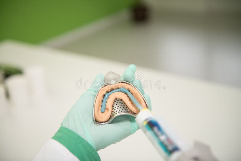 Close-upschot van Tandindruk met Implant royalty-vrije stock fotografie Close-upschot van Tandindruk met Implant royalty-vrije stock fotografie