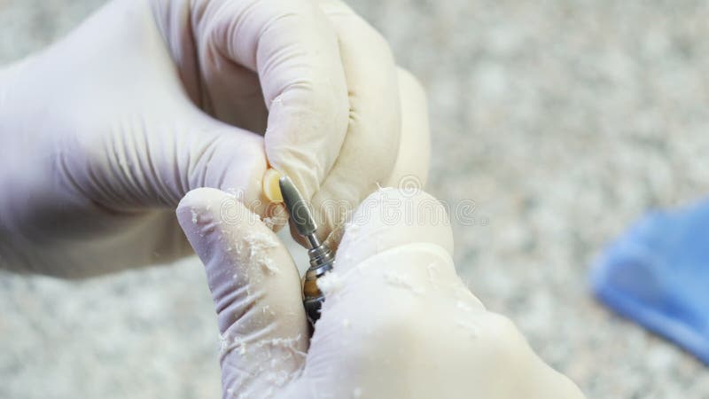Closeup of a dental technician making of denture in a dental lab stock video