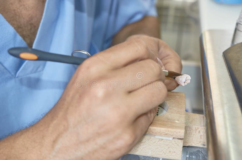 Closeup of Dental Technician Putting Ceramic To Dental Implants Stock