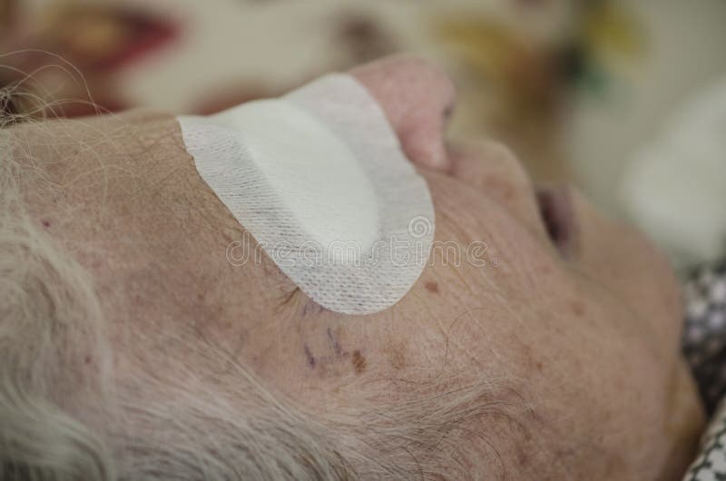 Eye of an old person with bandage after cataract operation royalty free stock images Eye of an old person with bandage after cataract operation royalty free stock images